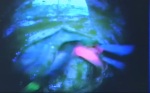 Operace mozkového nádoru s využitím fluorescence. Autor: Česká televize