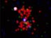 22.02.2001 - 3C294: Vzdálená rentgenová kupa galaxií