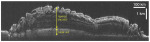 Radarový průřez vrstvami severní polární čepičky Marsu
