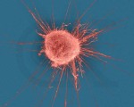 Rakovinová buňka. Zdroj: www.alternative-cancer.net.