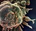 02.06.2020 - Na lidstvo útočí nový koronavirus